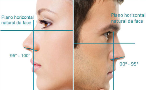 cirurgia plastica nariz