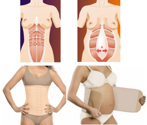 plastica na barriga