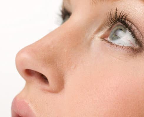 rinoplastia
