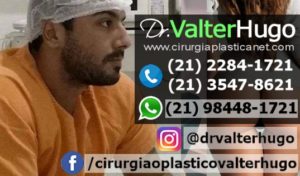 dr valter hugo melhor cirurgião plastico RJ